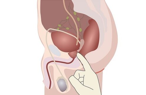 anatomi prostat lelaki